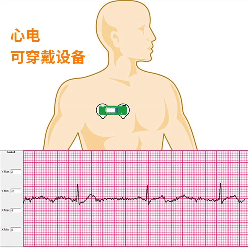 BMD101 ECG Electrocardiogram S - Ecg Patch Monitor 리뷰 및 가격